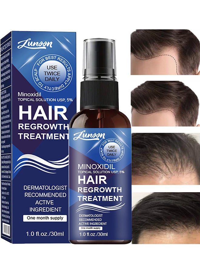 LUNOON - Minoxidil Hair Regrowth Treatment - Growth Spray For Men And Women, 5% Minoxidil Hair Serum For Stronger Thicker Longer Hair Help To Stop Thinning And Loss Hair 30ML - Image 1