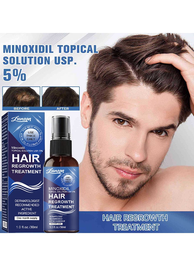 LUNOON - Minoxidil Hair Regrowth Treatment - Growth Spray For Men And Women, 5% Minoxidil Hair Serum For Stronger Thicker Longer Hair Help To Stop Thinning And Loss Hair 30ML - Image 1