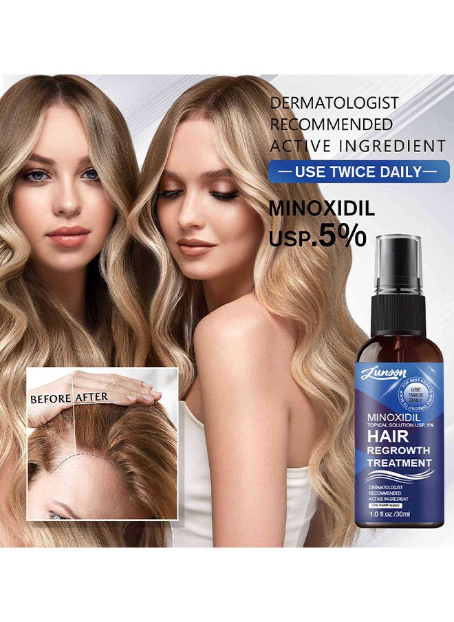LUNOON - Minoxidil Hair Regrowth Treatment - Growth Spray For Men And Women, 5% Minoxidil Hair Serum For Stronger Thicker Longer Hair Help To Stop Thinning And Loss Hair 30ML - Image 1