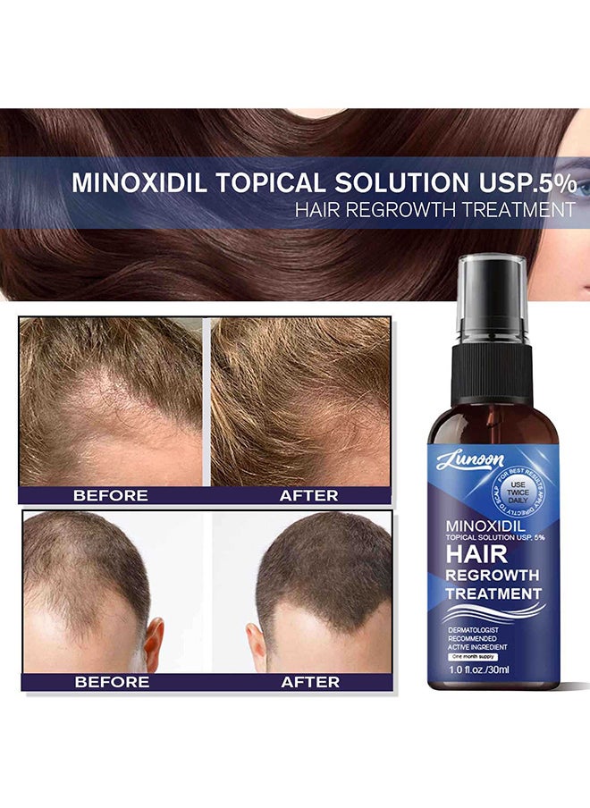 LUNOON - Minoxidil Hair Regrowth Treatment - Growth Spray For Men And Women, 5% Minoxidil Hair Serum For Stronger Thicker Longer Hair Help To Stop Thinning And Loss Hair 30ML - Image 1