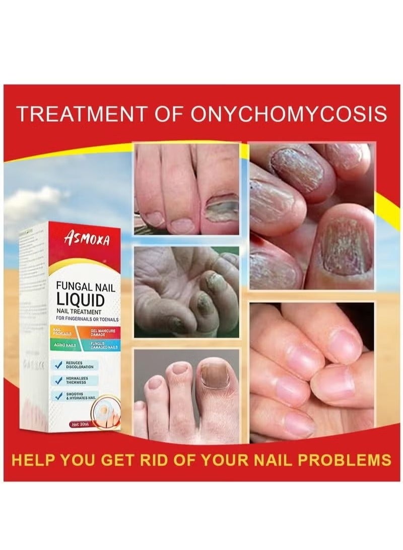 ASMOXA Fungal Nail Treatment Liquid Nail Fungus Treatment for Toenails & Fingernails Fungal Nail Renewal Anti Fungus Nail Repair Smooth & Hydrates Nail Reduce Discoloration 30ml - Image 1