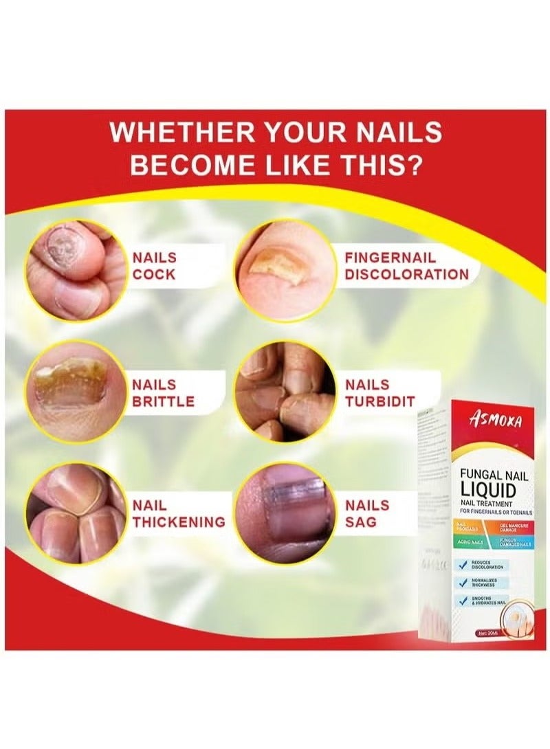 ASMOXA Fungal Nail Treatment Liquid Nail Fungus Treatment for Toenails & Fingernails Fungal Nail Renewal Anti Fungus Nail Repair Smooth & Hydrates Nail Reduce Discoloration 30ml - Image 3