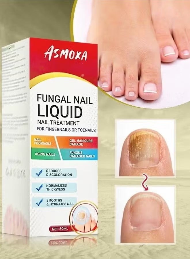 ASMOXA Fungal Nail Treatment Liquid Nail Fungus Treatment for Toenails & Fingernails Fungal Nail Renewal Anti Fungus Nail Repair Smooth & Hydrates Nail Reduce Discoloration 30ml - Image 4