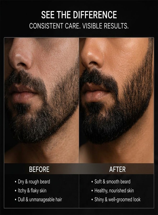 Qraa Men Mooch & Beard Oil For Beard Growth & Nourishment Enriched With Essential Oils (30ml) Pack of 1 - Image 3