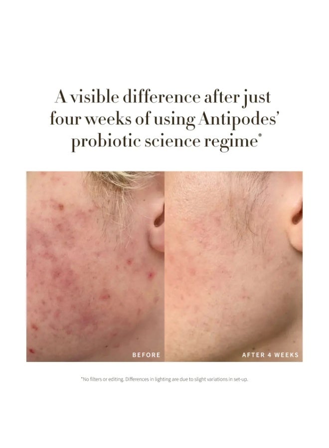 Antipodes Credo Probiotic Anti-Blemish Serum 30ml - Image 3