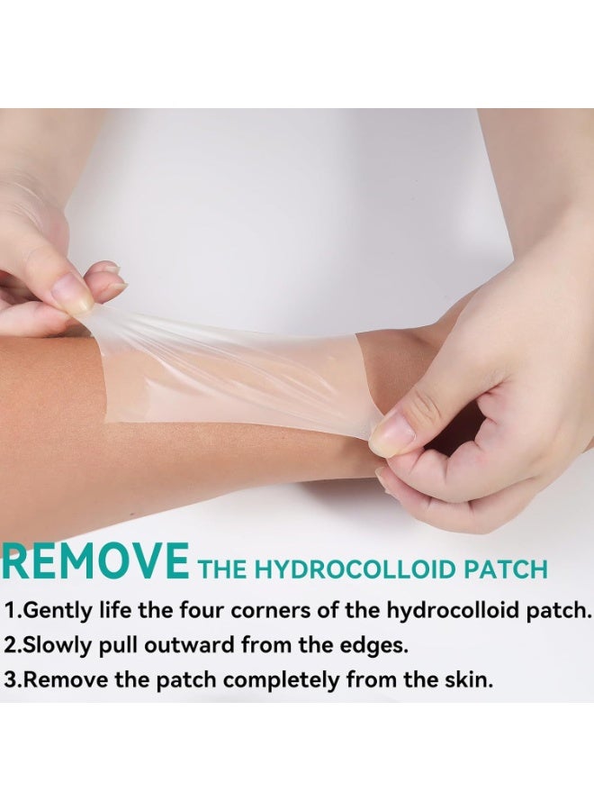 general Hydrocolloid dressing coil wound care dressing absorbs exudate band-aid hydrocolloid coil - Image 2