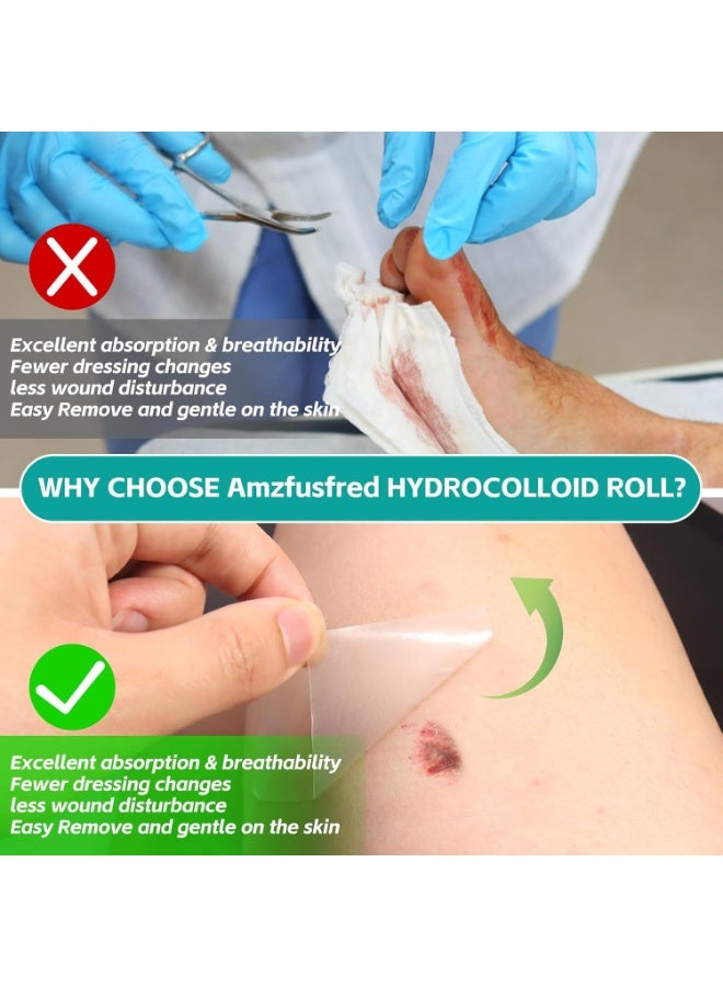 general Hydrocolloid dressing coil wound care dressing absorbs exudate band-aid hydrocolloid coil - Image 3