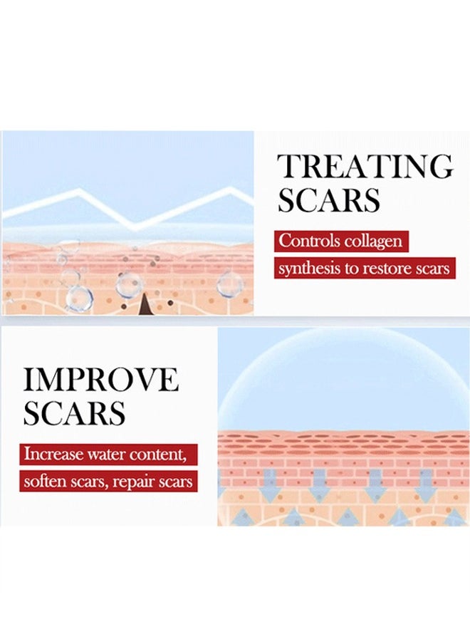 كيلو - كوت Tratamiento de las Cicatrices, جل علاج الندبات بتركيبة متطورة 15 جم، يساعد على تنعيم وتنعيم الندبات المرتفعة، ويحافظ على توازن الرطوبة في الجلد المجاور، ويقلل من تغير اللون والاحمرار والألم وعدم الراح  - Image 4