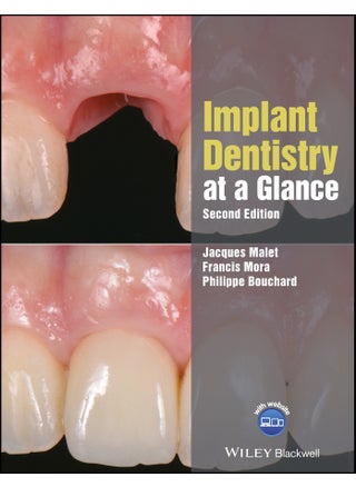 Implant Dentistry at a Glance - pzsku/ZEC6C27013E5DF110D0CAZ/45/_/1734598705/d6844a88-b832-4042-882f-699f73548789