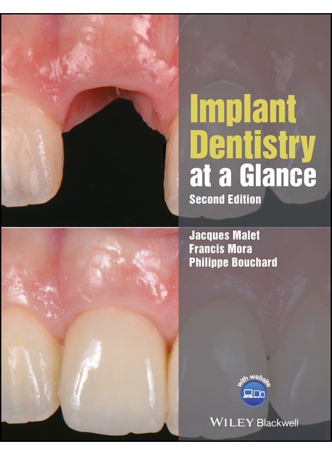Implant Dentistry at a Glance