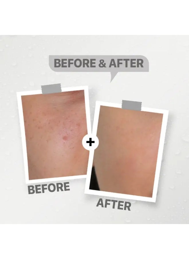 See-Lit - see-lit Advanced Niacinamide 20% Serum - Image 1