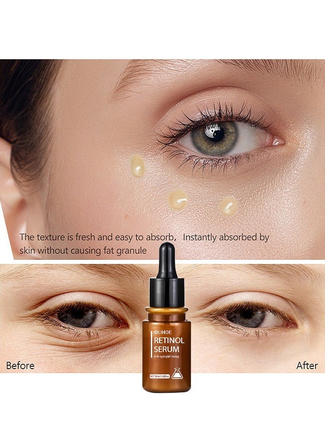 OUHOE - Anti-Aging And Firming Retinol Serum, Vitamine E And Antioxidants Hyaluronic Acid Anti-Aging Serum, Reduces Wrinkles, Fine Lines, Age Spots, Sun Spots, Anti Wrinkle Facial Serum 30ML - Image 1