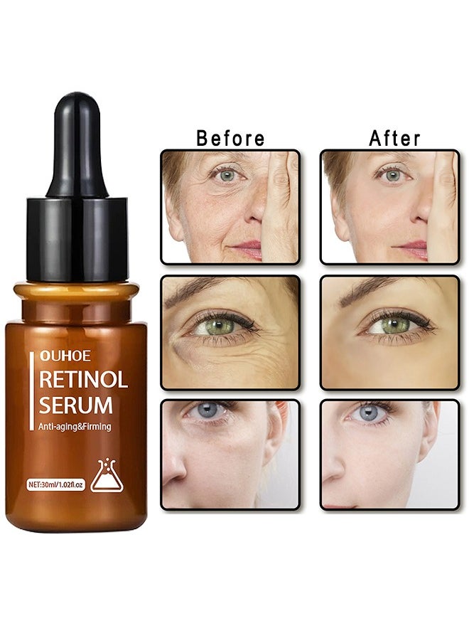 OUHOE - Anti-Aging And Firming Retinol Serum, Vitamine E And Antioxidants Hyaluronic Acid Anti-Aging Serum, Reduces Wrinkles, Fine Lines, Age Spots, Sun Spots, Anti Wrinkle Facial Serum 30ML - Image 1