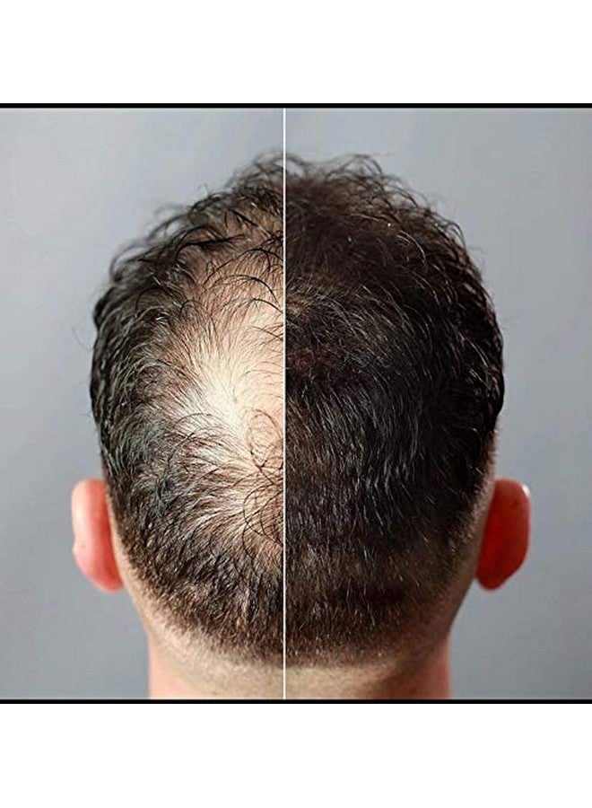 جوفينايل ألياف شعر بني فاتح 25 جرام - Image 4