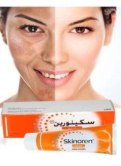 Skinoren Skinoren Whitening Cream for All Skin Types (30g)  - Image 2