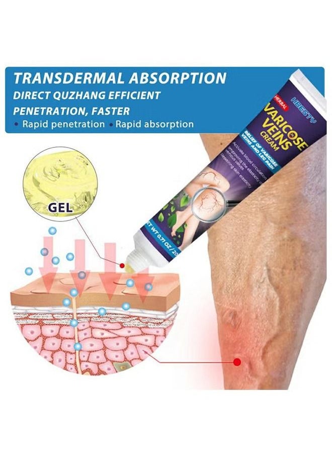 HBESTY - Varicose Veins Cream Relief Phlebitis Angiitis 100% Natural Ingredients Added Eliminate the Appearance of Varicose Veins - Vein Inflammation Treatment for Men & Women 20g - Image 1