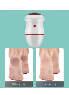 SYOSI Electric Callus Remover Vacuum Adsorption Foot Grinder Usb Pedicure Care Tools Absorbing Dual-Speed For Dead Hard Cracked Dry Skin  - Image 3