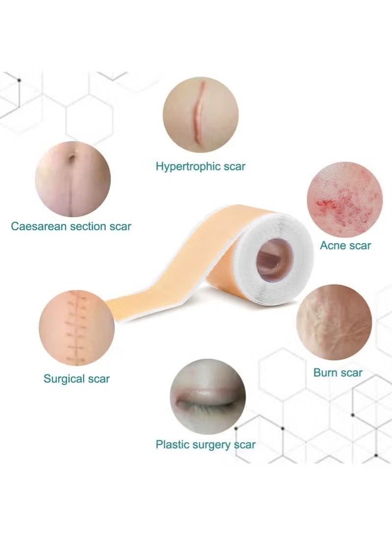 ناكسي فلاي لصقات سيليكون لإزالة الندبات لصقات سيليكون جراحية للبشرة الحساسة 4سم15م ريوسكلابل سيليكون للندبات الجراحية والحروق - Image 3