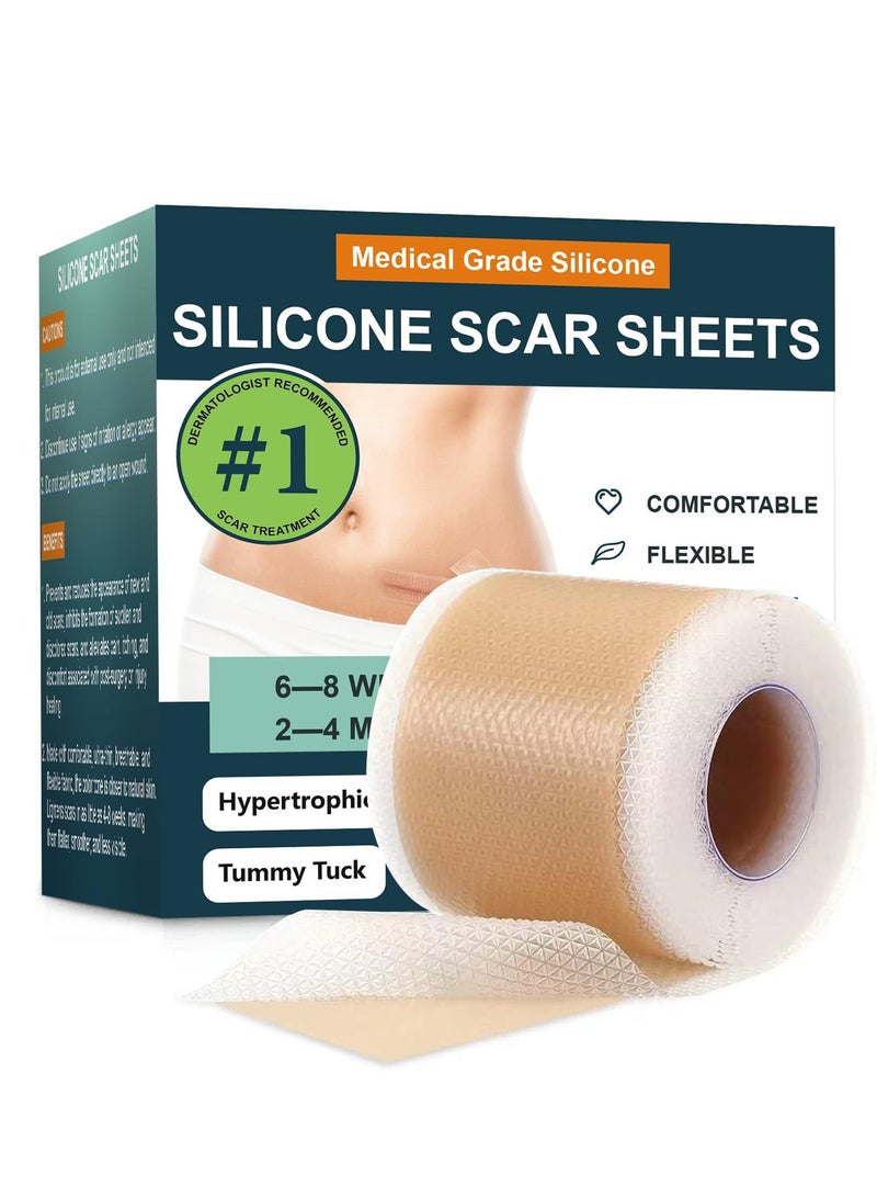 ناكسي فلاي لصقات سيليكون لإزالة الندبات لصقات سيليكون جراحية للبشرة الحساسة 4سم15م ريوسكلابل سيليكون للندبات الجراحية والحروق - Image 1