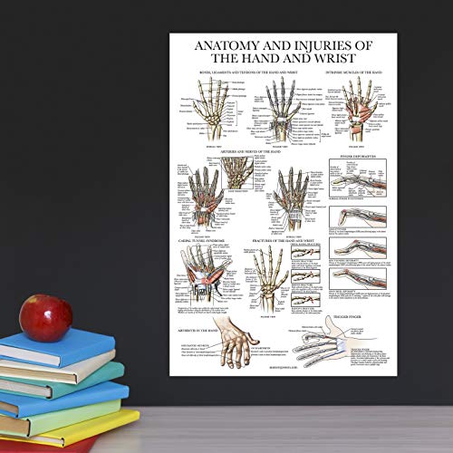 Palace Learning Laminated Anatomy and Injuries of the Hand and Wrist Poster - Hand and Wrist Joint Anatomical Chart - 18" x 24" - Image 5
