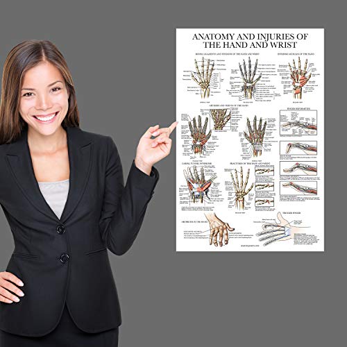 Palace Learning Laminated Anatomy and Injuries of the Hand and Wrist Poster - Hand and Wrist Joint Anatomical Chart - 18" x 24" - Image 4
