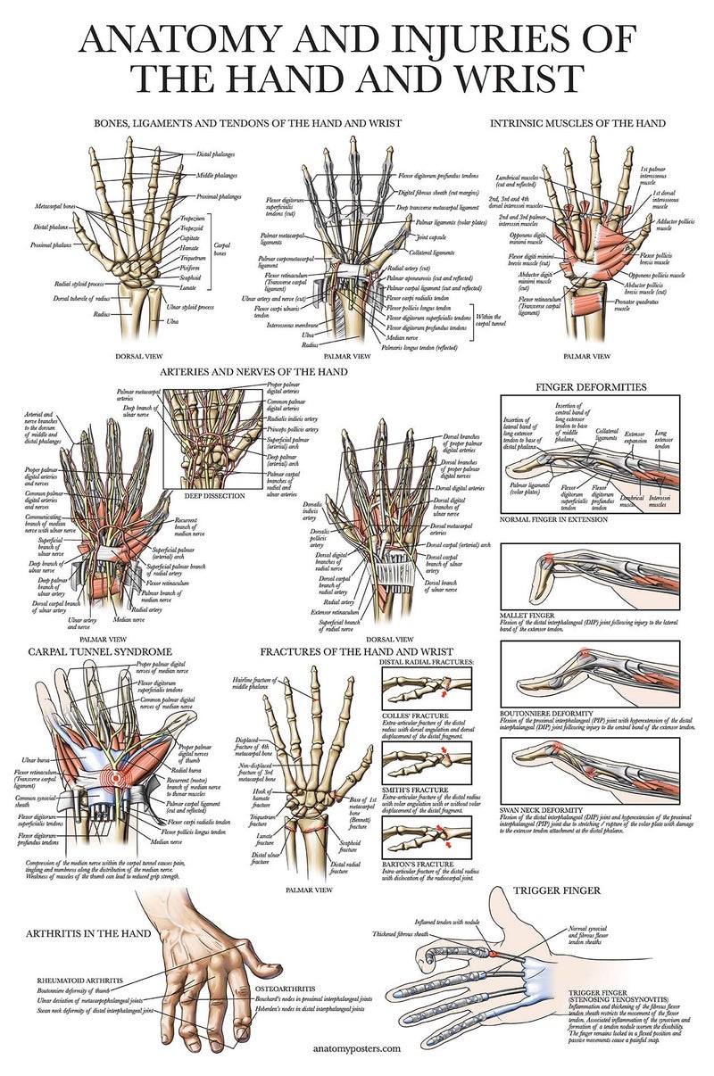 Palace Learning Laminated Anatomy and Injuries of the Hand and Wrist Poster - Hand and Wrist Joint Anatomical Chart - 18" x 24" - Image 1