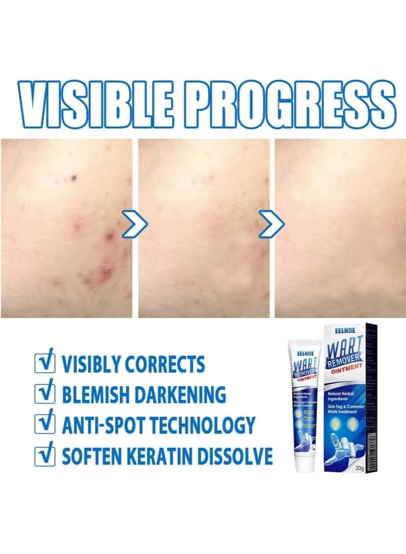 EELHOE Wart Remover Gentle Skin Tag Remover Repair Ointment Fast Acting Natural Formula Safe Effective Wart Remover Treatment - Image 3
