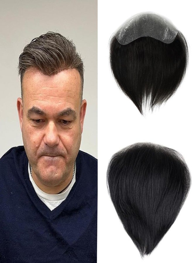 Pinaka Front line Hair Patch Frontal Hairpiece for Men Natural Hair Color Hairline Loss Straight Tape in Human Hair Toppers Replacement Toupee (Natural Black) - Image 1