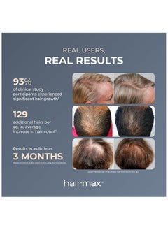 Hairmax HairMax LaserBand 41: FDA Cleared Laser Hair Growth Band for Women and Men, Full Scalp Coverage, Stimulates Growth for Denser, Fuller Hair  - Image 4