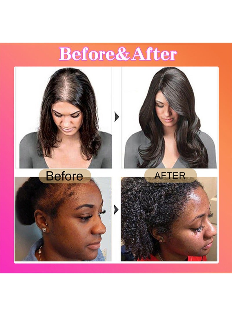 Lanthome Batana Oil Conditioner，Hair Growth Batana Oil Hair Growth Conditioner That Helps Repair Damaged Hair And Eliminate Split Ends For Men And Women (120ml) - Image 4