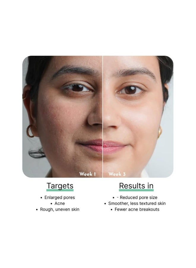 CosIQ Cos-IQ B3 5% Niacinamide Face Serum for Clear Glowing Skin, Reduces Dullness, Hydrates & Repairs Skin with Vit B3 & Hyaluronic Acid, Day & Night Serum | For Women & Men | 30ml - Image 3