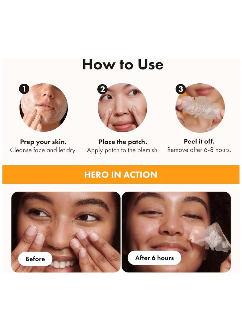 Mighty Patch Nose from Hero Cosmetics - XL Hydrocolloid Patches for Nose Pores, Pimples, Zits and Oil - Dermatologist-Approved Overnight Pore Strips to Absorb Acne Nose Gunk (10 Count)  - Image 4