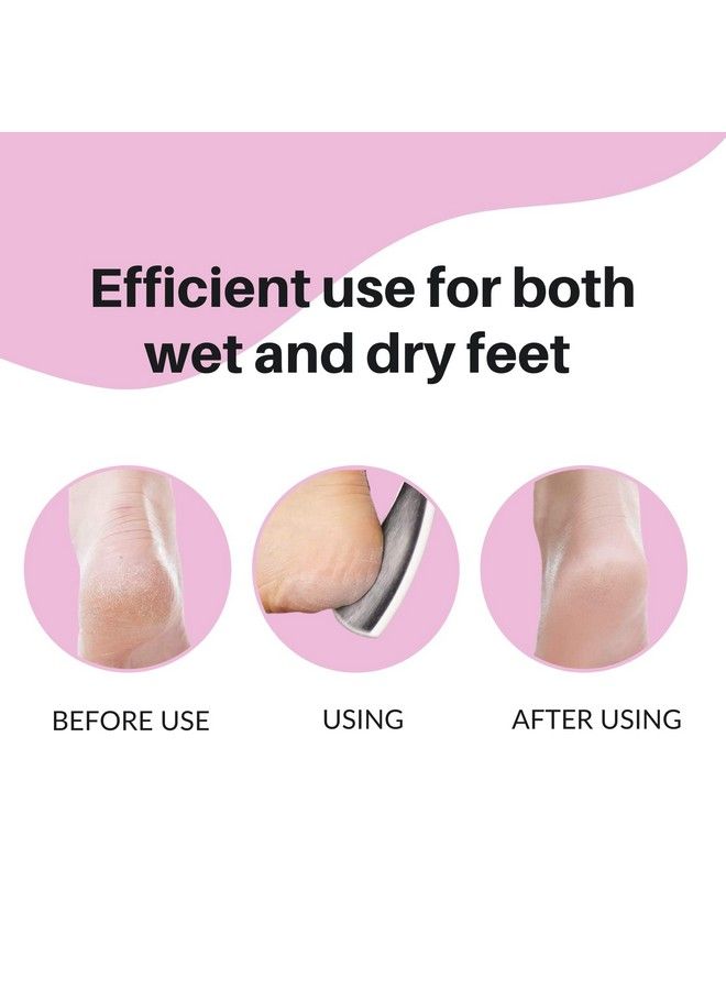 Triton Emery Professional Dual Sided Foot Scraperfiler For Hard N Dead Skin Callus Remover Pedicure Foot Scrubber For Men N Women - Image 4