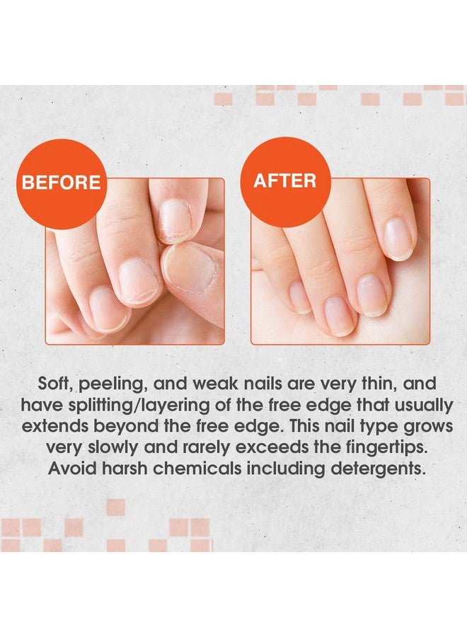 Nail Tek Intensive Therapy 2 For Weak Thin Soft Peeling Nails With Protein Formula Reinforces Thickens Nails Promotes Strength And Flexibility 0.5 Ounce 1 Pack - Image 3