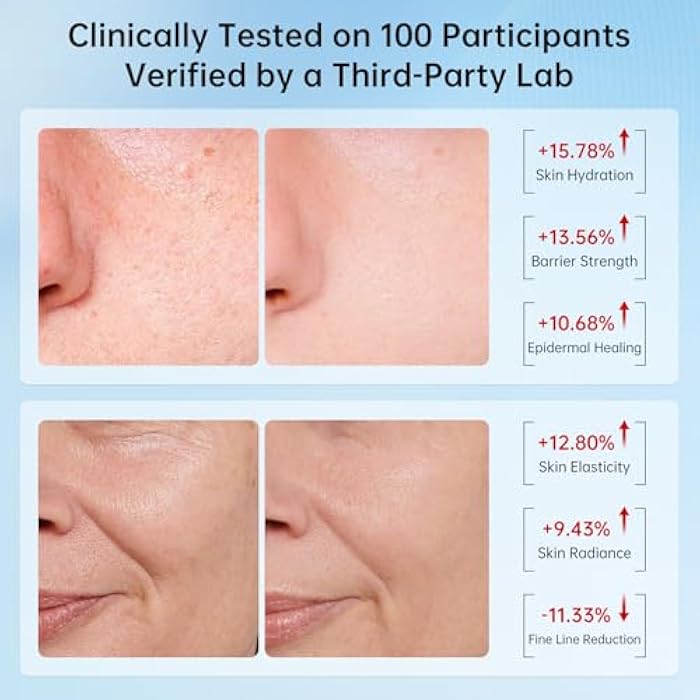 VGO Snail Mucin 92% Moisturizer Daily Face Moisturizer Hydrating Repair Face Gel Cream for Dry & Sensitive Skin, All Skin Types 50g / 1.76oz - Image 4