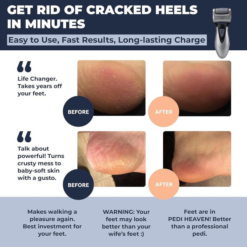 Own Harmony Electric Callus Remover for Feet: Best Pedicure Tools for Men by with 3 Rollers (Powerful), Electronic Pedi Care Spa Foot File - Perfect for Hard, Cracked, Dry, Dead Skin (USB Cable) - Image 2