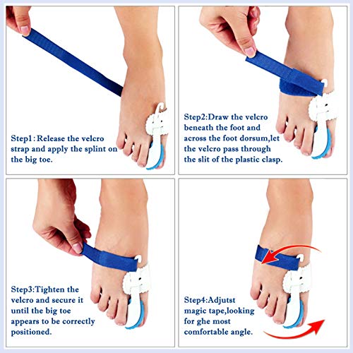 ERSANLI Bunion Corrector Brace for Pain Relief, Hallux Valgus Corrector & Big Toe Joint Support – Adjustable Night Splint for Men and Women, Comfortable Bunion Valgus Protective Cover (2Pcs) - Image 4