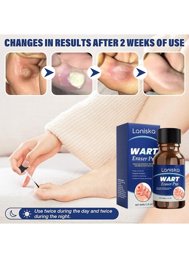 LANISKA Advanced Wart Remover, Wart Remover Liquid, Maximum Strength Wart Removal Fluid, Salicylic Acid Wart Remover, Fast Acting Formula For Plantar & Common Warts, Natural & Safe Treatment For Most Body Warts, 30ml - Image 4