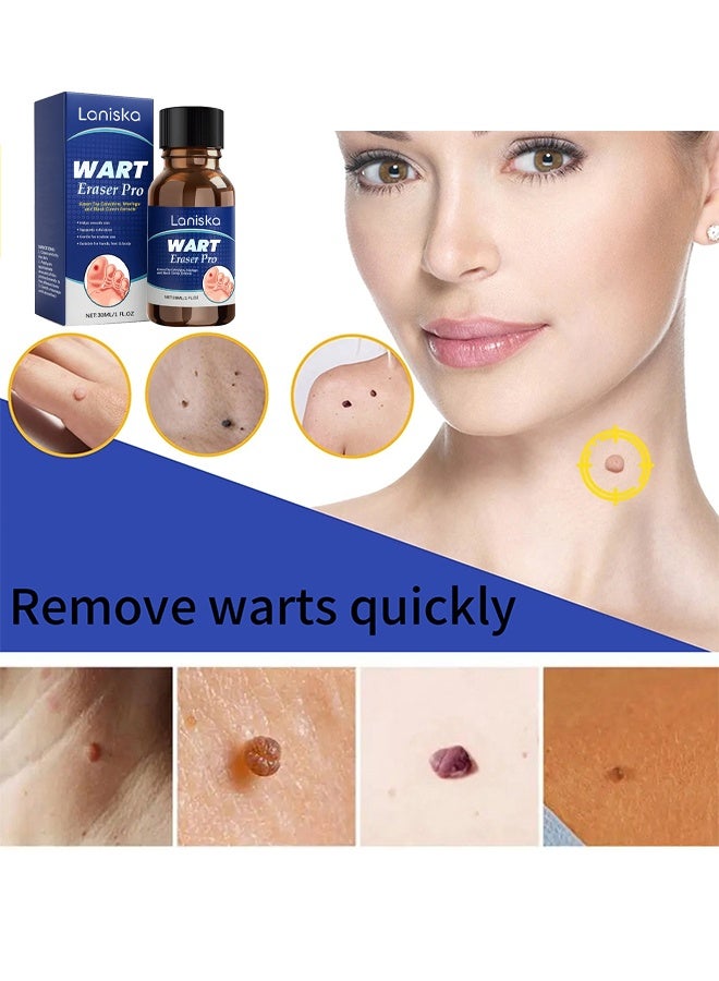 LANISKA Advanced Wart Remover, Wart Remover Liquid, Maximum Strength Wart Removal Fluid, Salicylic Acid Wart Remover, Fast Acting Formula For Plantar & Common Warts, Natural & Safe Treatment For Most Body Warts, 30ml - Image 2