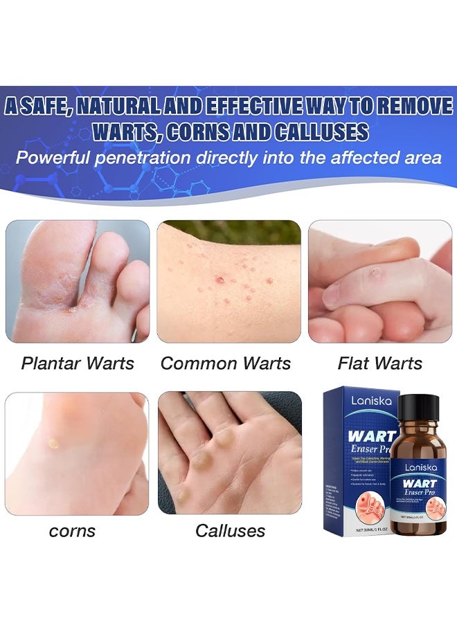 LANISKA Advanced Wart Remover, Wart Remover Liquid, Maximum Strength Wart Removal Fluid, Salicylic Acid Wart Remover, Fast Acting Formula For Plantar & Common Warts, Natural & Safe Treatment For Most Body Warts, 30ml - Image 3