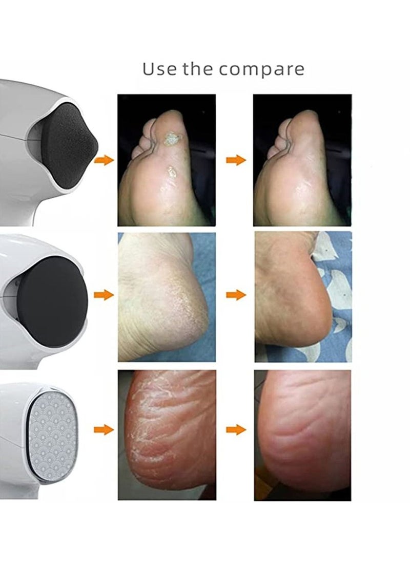 Generic - Electric Foot Callus Remover, USB Rechargeable Pedicure File Tools, Professional Electric Foot Grinder with 3 Grinding Heads, Heel Care Tool for Remove Hard Cracked Skin Dead Skin, 3 Speed - Image 1