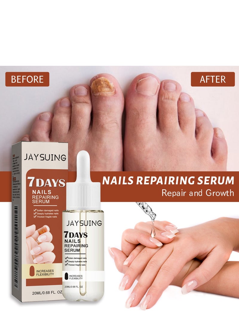 جايسوينغ زيت خلاصة إصلاح الأظافر، مصل مكثف لنمو الأظافر وقوتها، خلاصة مرطبة لعلاج فطريات الأظافر للعناية بالقدمين واليدين، سائل مضاد لالتهاب أظافر القدمين لإزالة الفطريات - Image 3