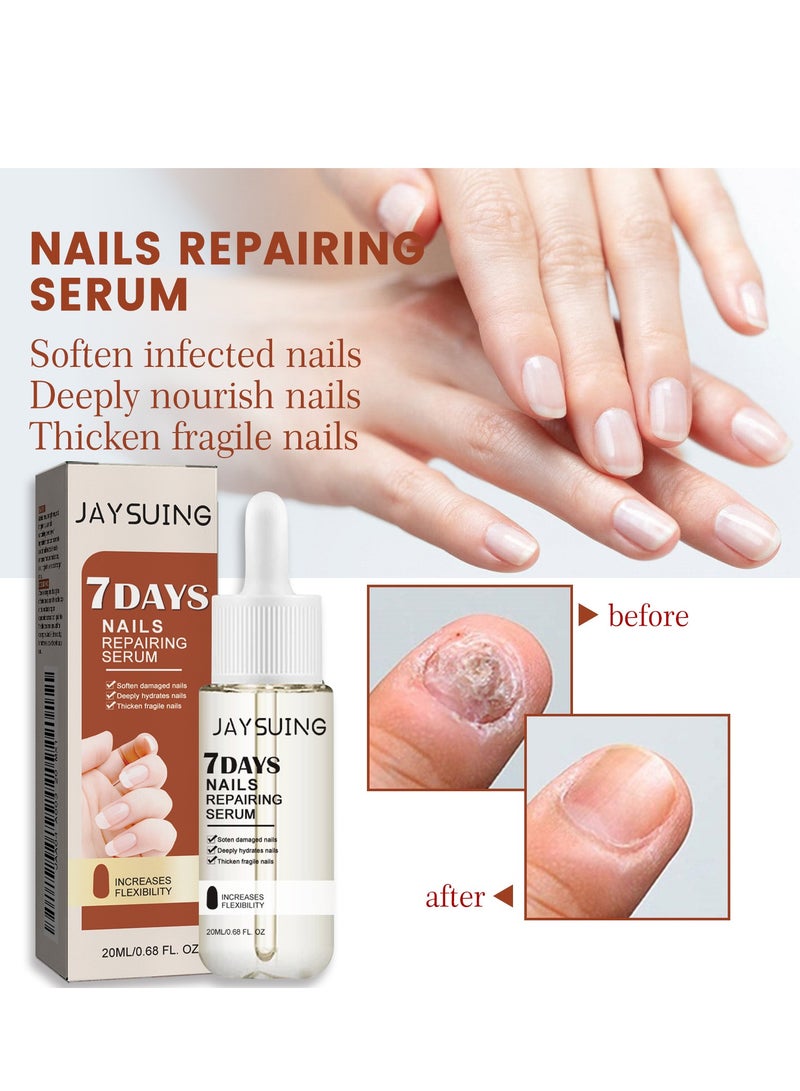 جايسوينغ زيت خلاصة إصلاح الأظافر، مصل مكثف لنمو الأظافر وقوتها، خلاصة مرطبة لعلاج فطريات الأظافر للعناية بالقدمين واليدين، سائل مضاد لالتهاب أظافر القدمين لإزالة الفطريات - Image 1