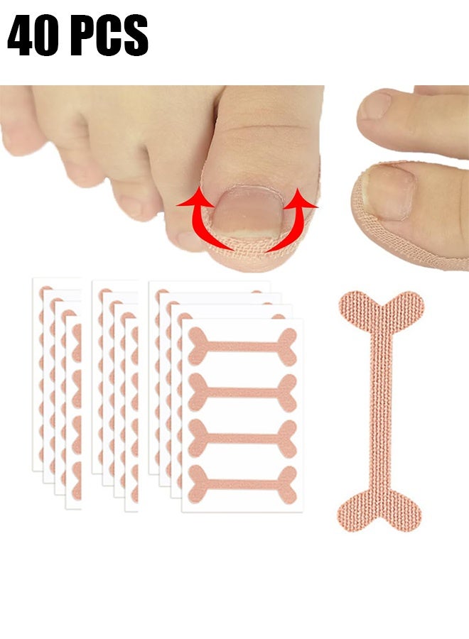 Ba Love Ingrown Toenail Treatment Strips, 40 Pcs Toe Nail Correction Patch Elastic Patch Sticker Corrector Pedicure Tools, Professional Glue-Free Toe Nail Treatment Tool, Foot care - Image 1