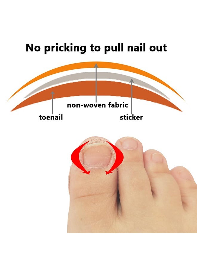 Ba Love Ingrown Toenail Treatment Strips, 40 Pcs Toe Nail Correction Patch Elastic Patch Sticker Corrector Pedicure Tools, Professional Glue-Free Toe Nail Treatment Tool, Foot care - Image 4