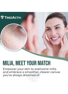 TreeActiv TreeActiv Milia Spot Treatment 3 Items Tool Kit, Pure Eye Milia Remover Treatment, Includes 0.5oz Overnight Milia Remover Cream with Bentonite Clay and Aloe Vera, Milia Extractor Tool Kit Acne Treat  - Image 3