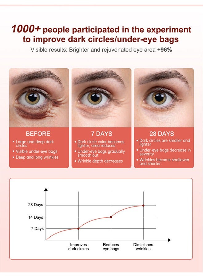 AuQuest Anti Dark Circles And Eye Bags Cream 20g, Fade Dark Circles, Remove Fine Lines and Eye Bags, Anti-Wrinkle Anti-Aging Firming Brighten Skin Cream, Eye Care Cream - Image 5