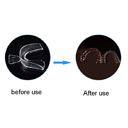Mouth Guard EVA Teeth Protector Night Guard Mouth Trays for Bruxism Grinding Anti-snoring Teeth Whitening Boxing Protection (Letest) - Image 3
