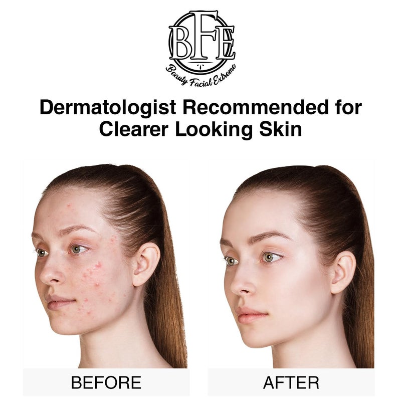 Beauty Facial Extreme Acne Treatment Pads- Eliminates Cystic Breakouts, Oily Skin & Clogged Pores. Clear Pimple, Whitehead, Blackhead, Dark Spots & Improve Skin Texture. - Image 3