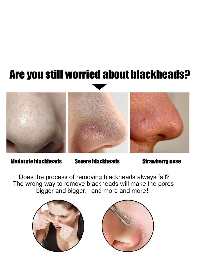 إيلهو رقعة الأنف العميقة للتنظيف ، شرائط الأنف لإزالة الرؤوس السوداء ، ينظف غشاء الأنف ، يزيل انسداد المسام ، فعال لإزالة حب الشباب والرؤوس السوداء 10 قطع - Image 2